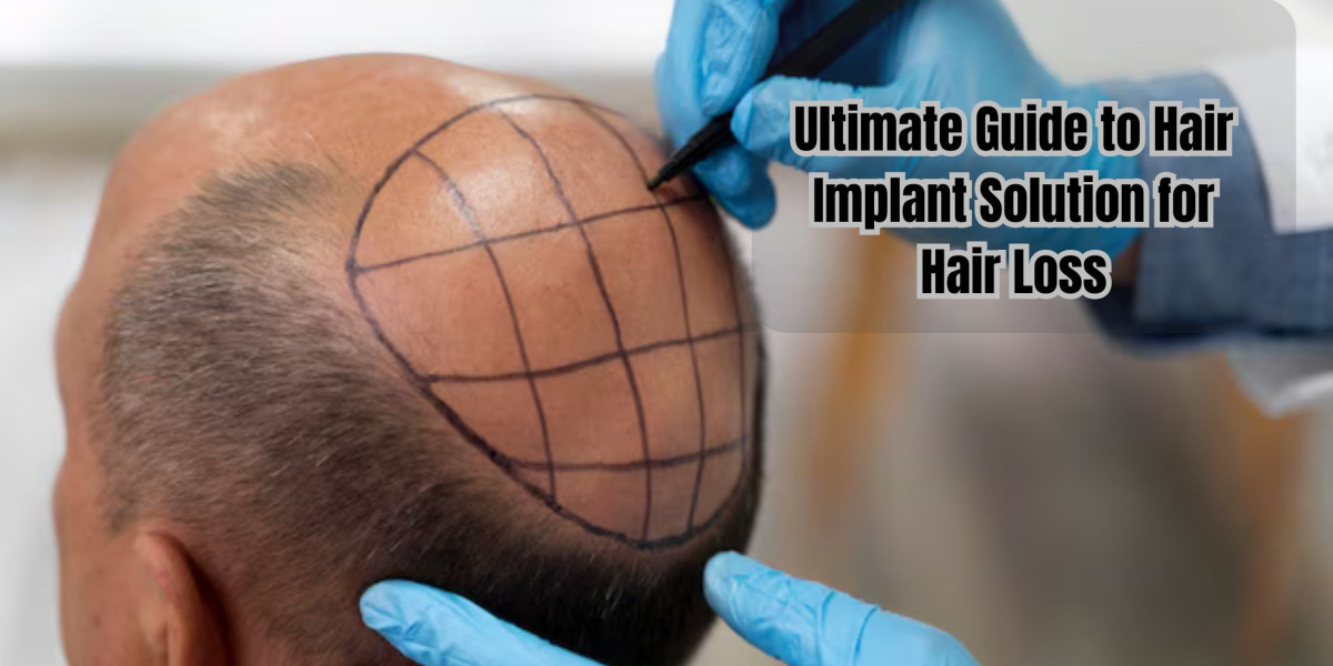 Ultimate Guide to Hair Implant Solution for Hair Loss